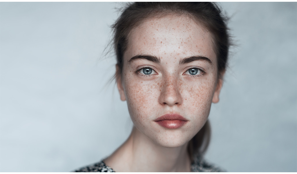 Blass im Gesicht? Ein fahler Teint ist eines der typischen Symptome für einen Vitamin B12-Mangel und der sich hieraus entwickelnden Störungen bei der Blutbildung. Blasse junge Frau: Blässe kann ein Vitamin B12-Mangel-Symptom sein